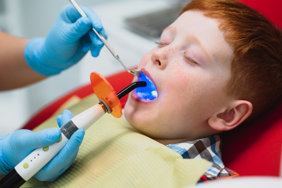 dental sealants methuen