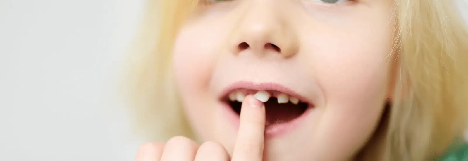 loosing baby teeth