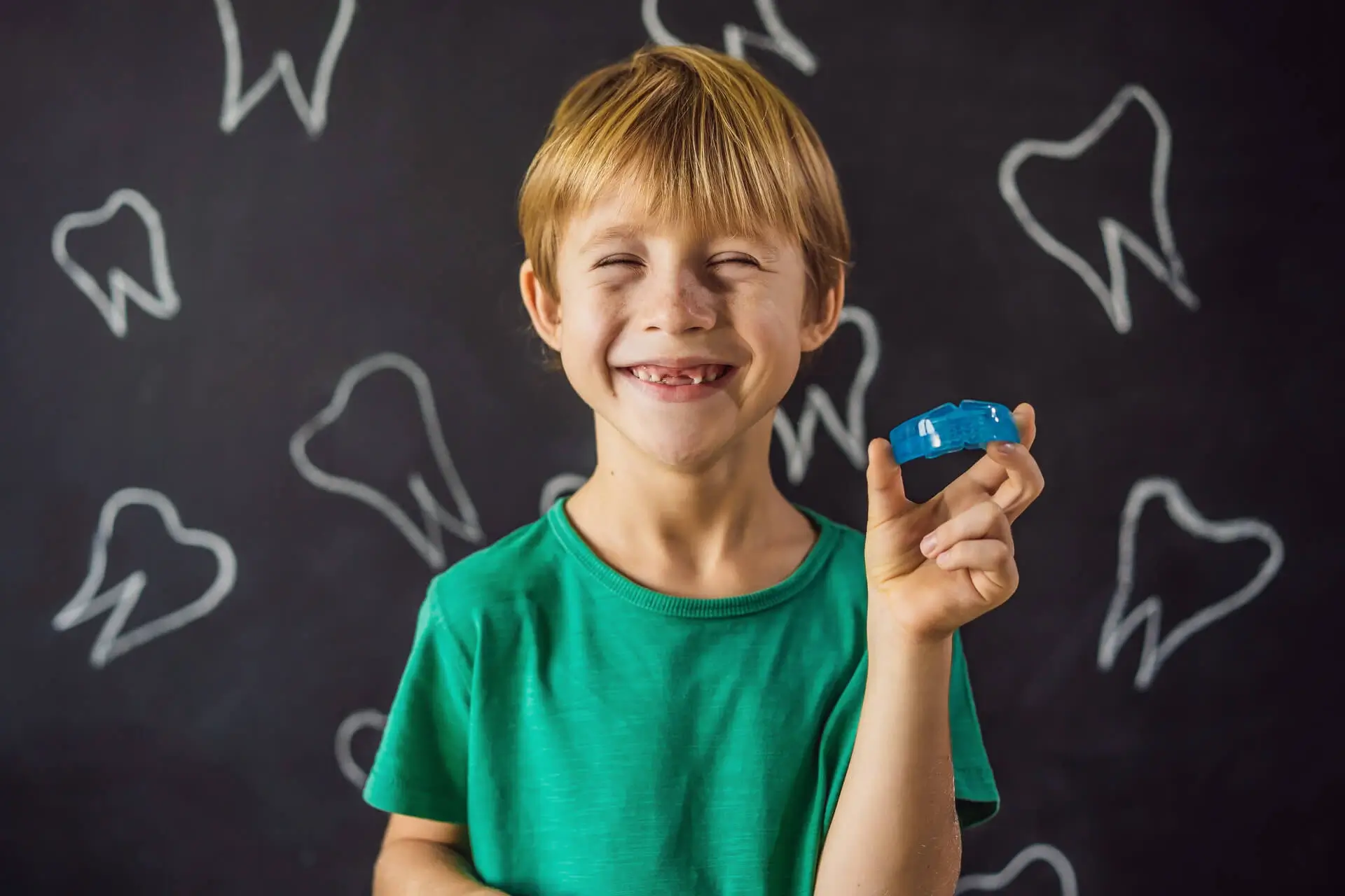 Mouthguard
