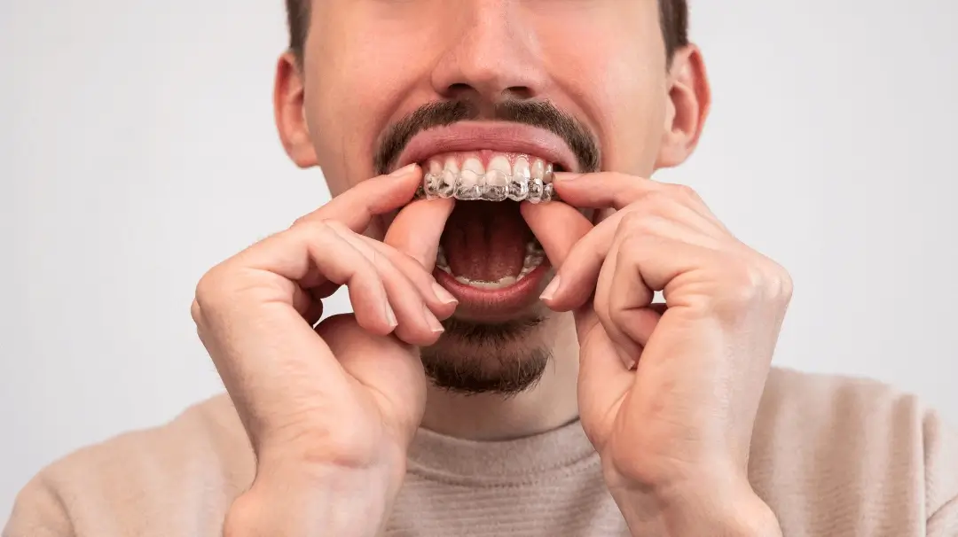 retainers