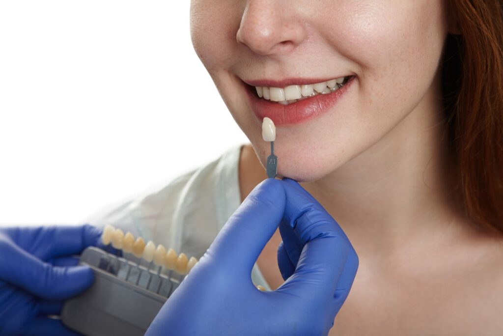 Dental Crown