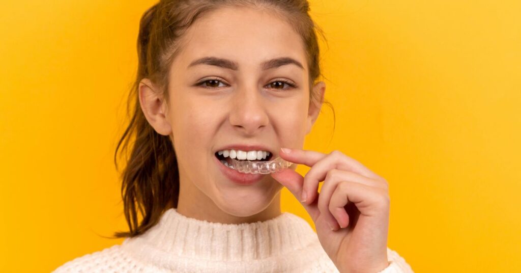 How Does Invisalign Work for Growing Children? 1 invisalign