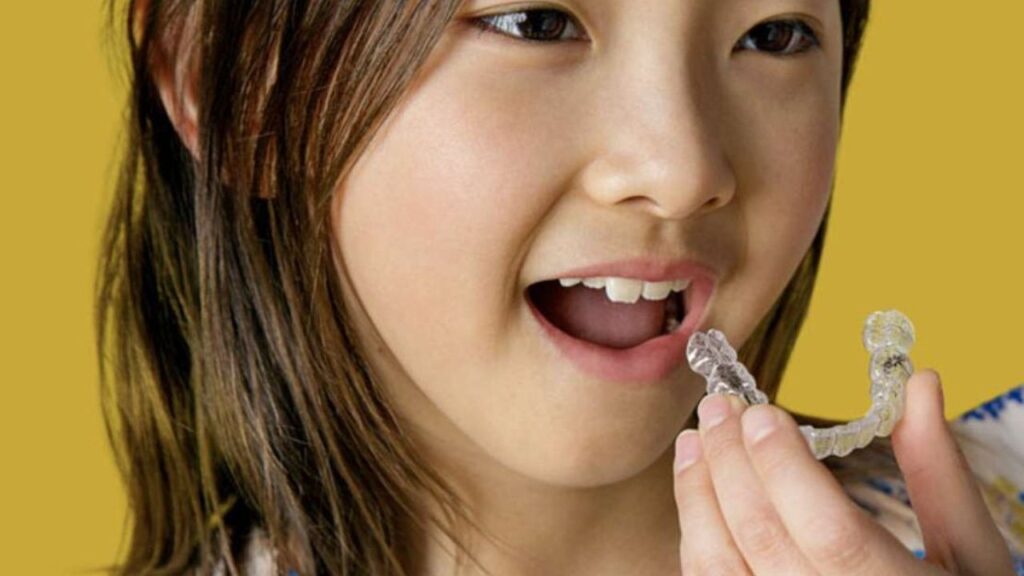 What Habits Can Affect Invisalign Results in Children? 1 Invisalign in Methuen 2