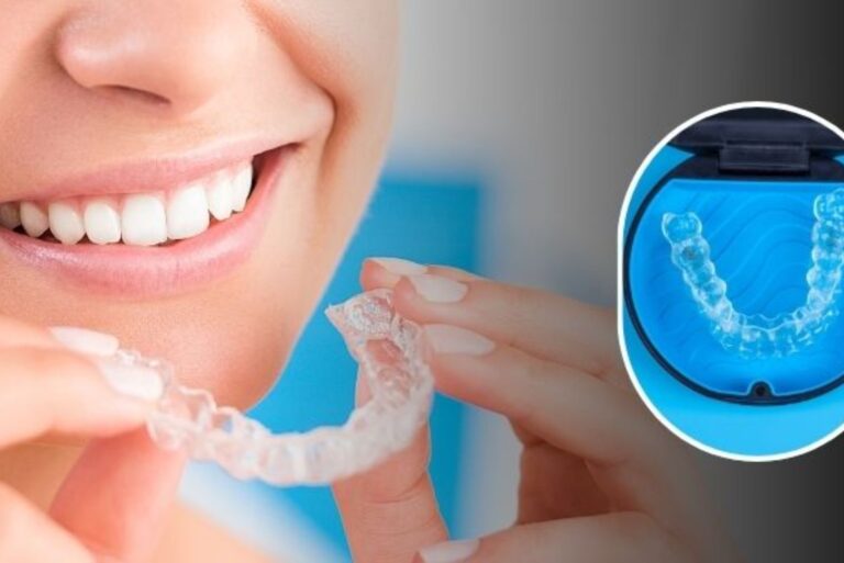 Invisalign