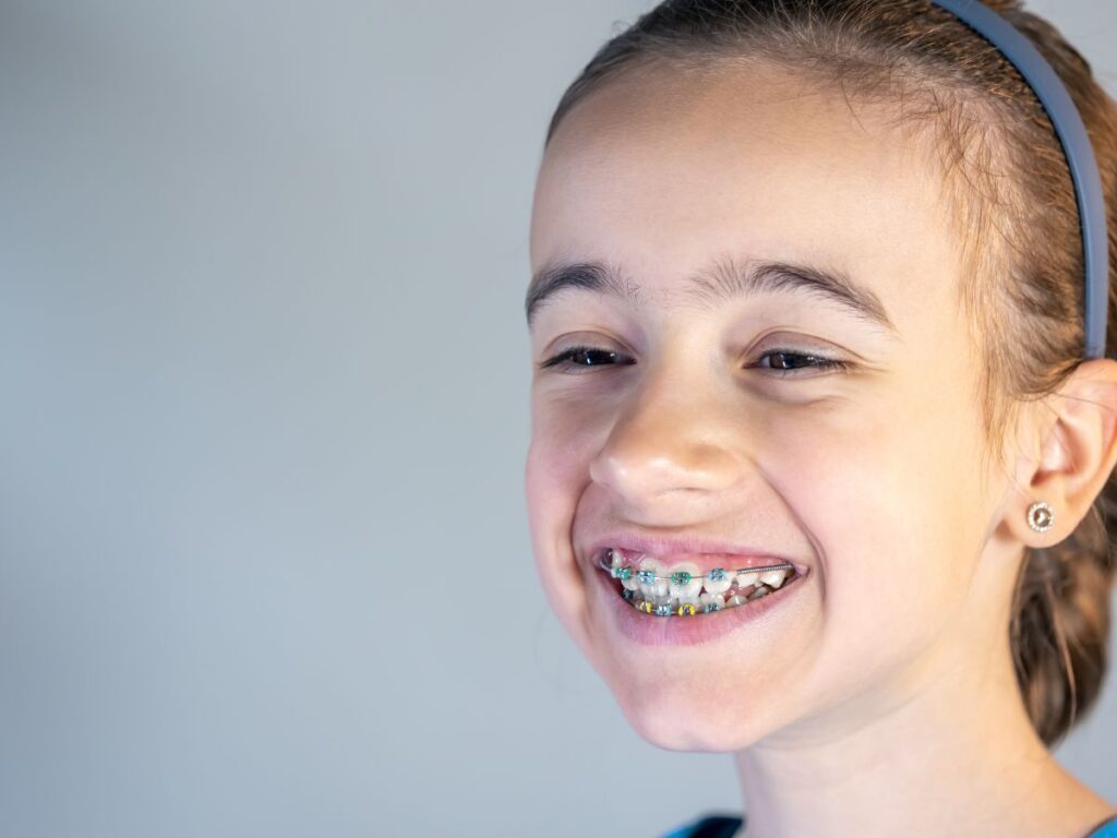 How Do Braces Affect Jaw Growth in Children Over Time? 1 Braces for Kids 3