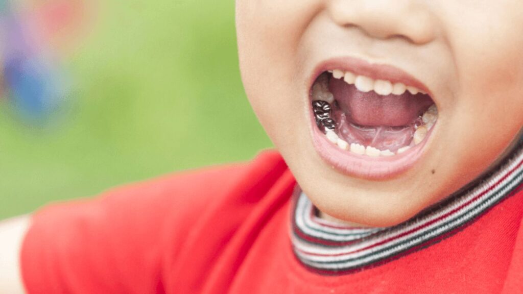 What Types of Dental Crowns Are Best for Children's Teeth? 1 Dental Crown in Methuen