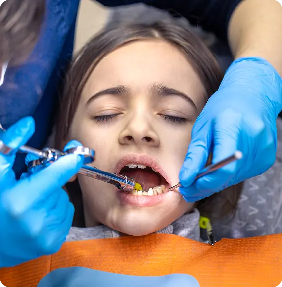 Dental Sealants