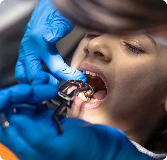 When Does a Child Need a Tooth Removed