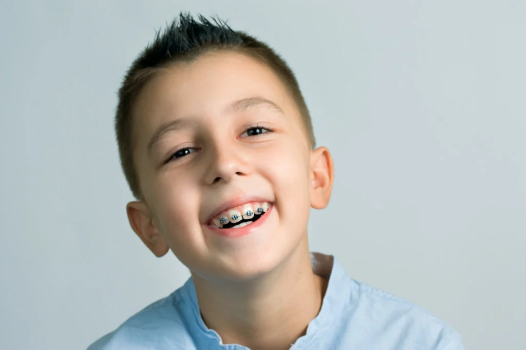 Braces and Invisalign for Andover Including Adults