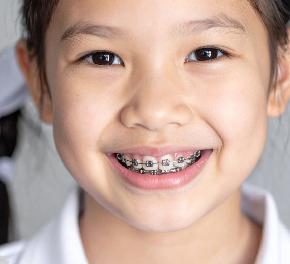 Braces and Invisalign for Haverhill Kids, Teens, and Adults