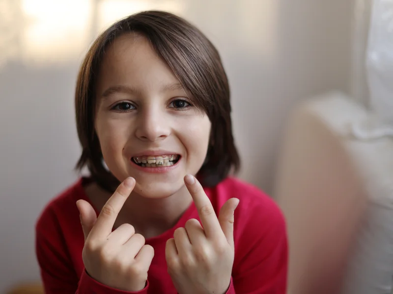 Ceramic Braces in Methuen MA