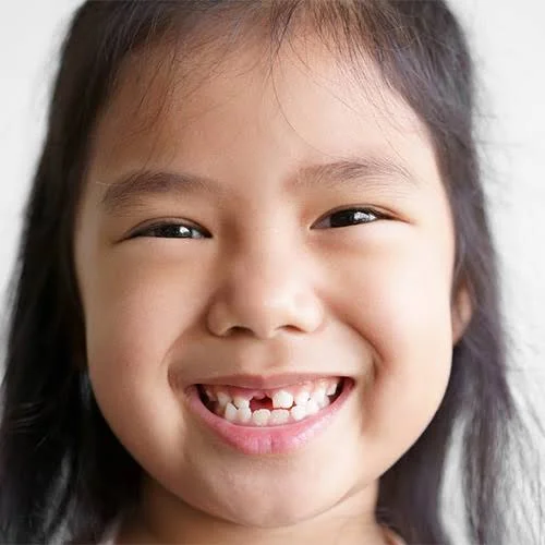 When Your Child May Need a Space Maintainer